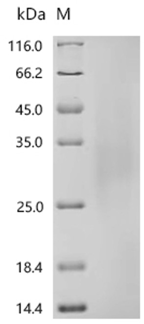 Recombinant Human Collagen alpha-1 (XVIII) chain (COL18A1), partial (CSB-YP005725HU4c7) Recombinant Human Collagen alpha-1 (XVIII) chain (COL18A1), partial (CSB-YP005725HU4c7)