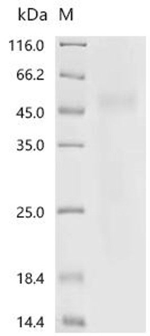 Recombinant Human Collagen alpha-1 (XVIII) chain (COL18A1), partial (CSB-YP005725HU4)