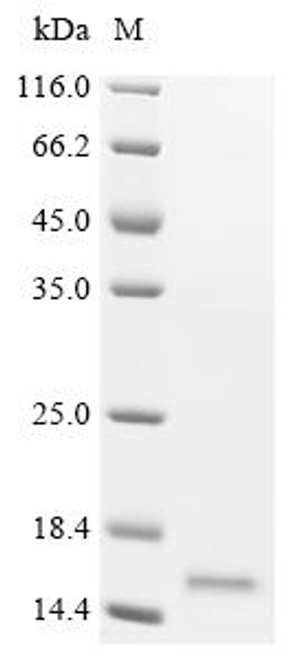 Recombinant Human Bromodomain-containing protein 2 (BRD2), partial (CSB-YP002800HU) Recombinant Human Bromodomain-containing protein 2 (BRD2), partial (CSB-YP002800HU)