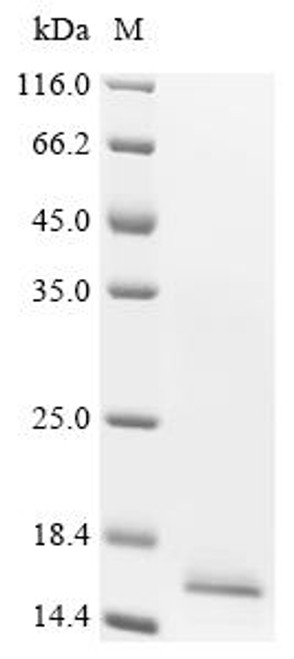 Recombinant Human Bromodomain-containing protein 2 (BRD2), partial (CSB-YP002800HU1)