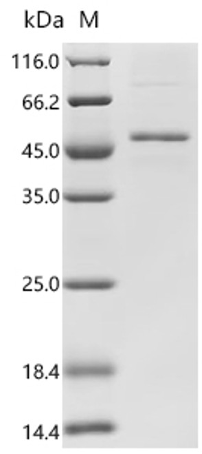Recombinant Human Follicle-stimulating hormone receptor (FSHR), partial (CSB-EP009021HUc7)