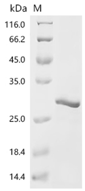 Recombinant Mouse Cold-inducible RNA-binding protein (Cirbp) (CSB-EP005440MOc7)