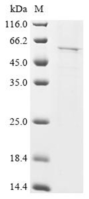 Recombinant Human Islet cell autoantigen 1 (ICA1) (CSB-BP010947HU(A4))