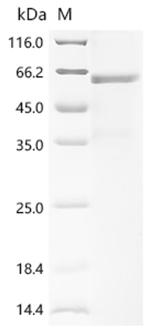 Recombinant Human Islet cell autoantigen 1 (ICA1) (CSB-BP010947HU(A4)d7)