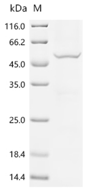 Recombinant Tick-borne encephalitis virus Far Eastern subtype Genome polyprotein, partial (CSB-BP357187TENd7)
