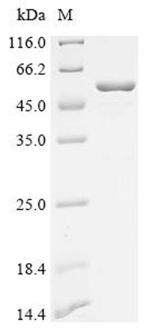 Recombinant Human Replication protein A 32 kDa subunit (RPA2), partial (CSB-BP020089HU1)