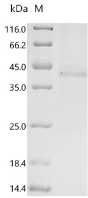 Recombinant Human herpesvirus 6A Immediate-early protein 1 (U90/U89), partial (CSB-BP721301HJZc7)
