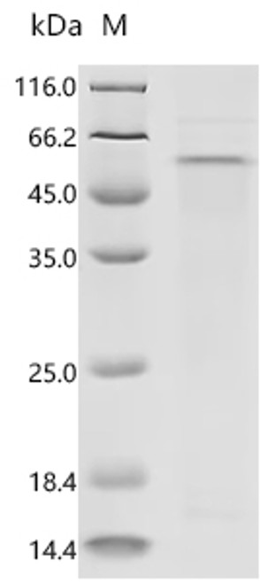 Recombinant Human herpesvirus 1 Capsid vertex component 1 (CVC1), partial (CSB-BP320621HWY)