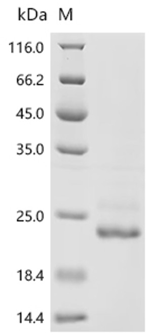 Recombinant Chlamydia pneumoniae Large cysteine-rich periplasmic protein OmcB (omcB), partial (CSB-BP326426DRZd7)