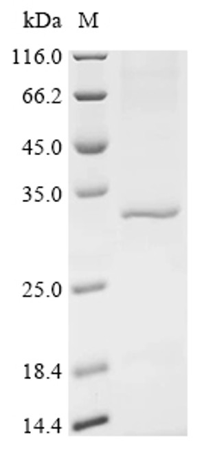 Recombinant Human Serine/threonine-protein phosphatase PGAM5, mitochondrial (PGAM5), partial (CSB-BP839338HU)