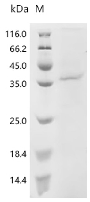 Recombinant Human Protein Wnt-5a (WNT5A) (CSB-BP026138HU)