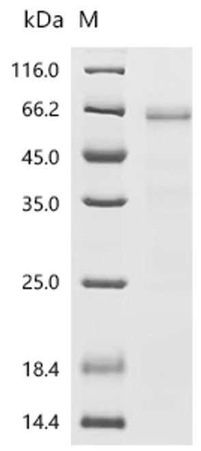 Recombinant Human Ubiquitin-like modifier-activating enzyme 6(UBA6), partial (CSB-BP025420HUe0)