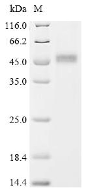 Recombinant Human Ubiquitin-like modifier-activating enzyme 6 (UBA6), partial (CSB-BP025420HU)