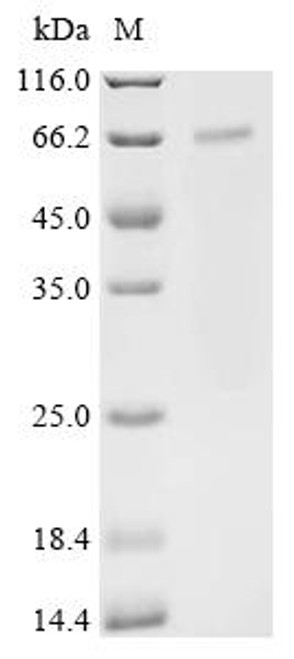 Recombinant Human TNF receptor-associated factor 3 (TRAF3) (CSB-BP024148HU)