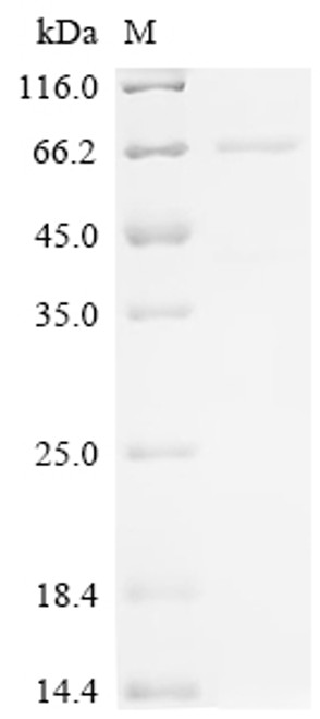 Recombinant Mouse Putative phospholipase B-like 2 (Plbd2) (CSB-BP663623MO)