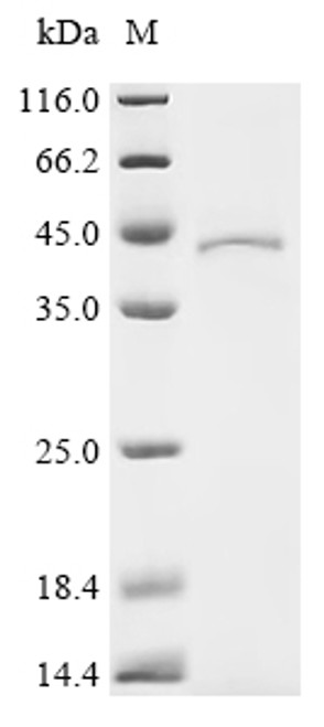 Recombinant Human Guanine nucleotide-binding protein G(q) subunit alpha (GNAQ) (CSB-BP342271HU)