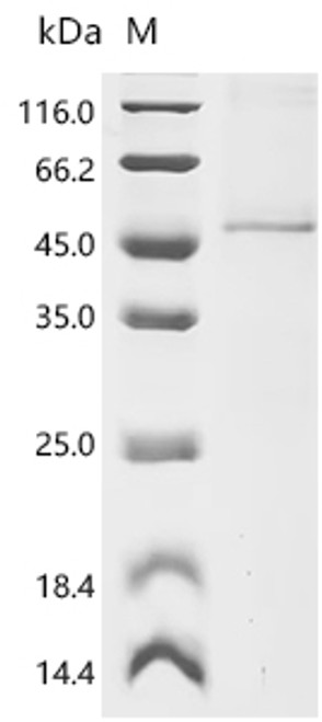 Recombinant Mouse Neurogenic differentiation factor 1 (Neurod1)(H115A) (CSB-BP720182MO(M2))