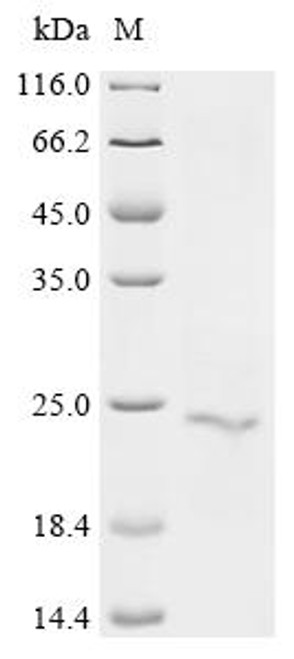 Recombinant Human Serine protease 1 (PRSS1) (CSB-BP018811HU)