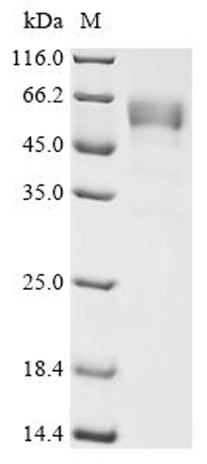 Recombinant Mouse Gamma-synuclein (Sncg) (CSB-MP5197MO)
