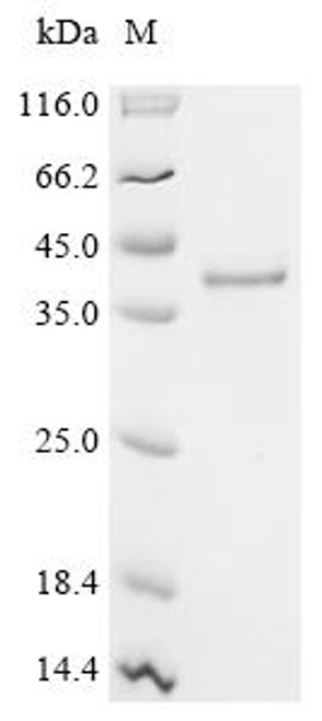 Recombinant Human Mammaglobin-B (SCGB2A1) (CSB-MP020816HU)