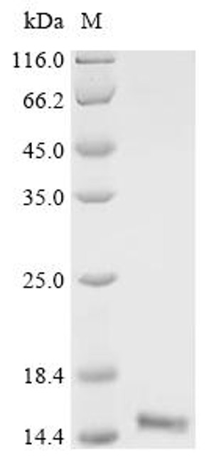 Recombinant Mouse Fatty acid-binding protein, adipocyte (Fabp4) (CSB-MP007945MO)