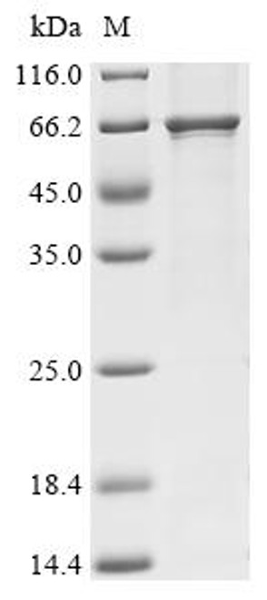 Recombinant Rat Klotho (Kl), partial (CSB-MP012377RA)