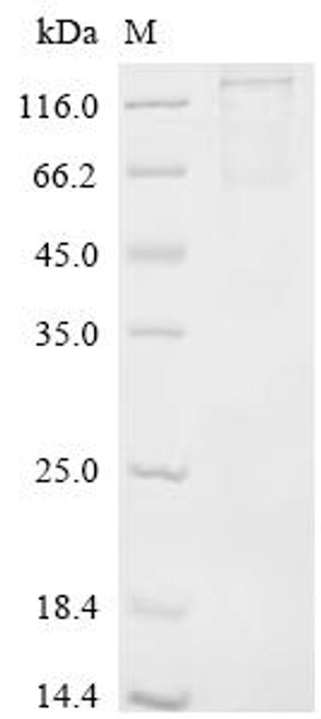 Recombinant Rat Coiled-coil domain containing 112 (Ccdc112) (CSB-MP5684RA)