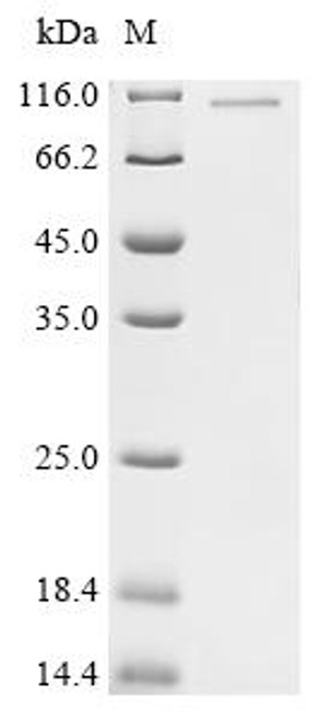 Recombinant Human Importin subunit alpha-1 (KPNA2) (CSB-MP012484HU)