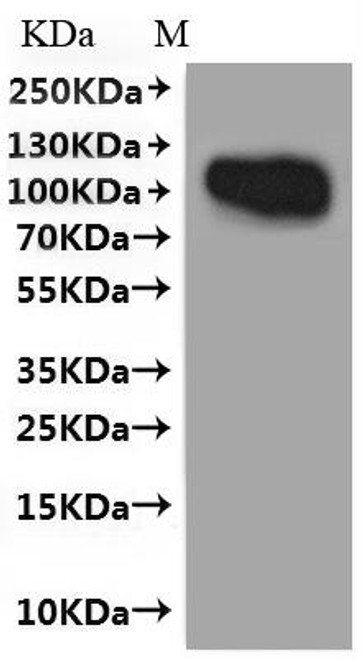 Recombinant Human T-cell surface antigen CD2 (CD2), Fluorescent-VLPs (CSB-MP004894HU(A4)f4)