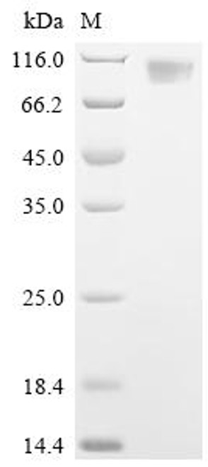 Recombinant Porcine epidemic diarrhea virus Spike glycoprotein (S), partial (CSB-MP5982GRQ3)