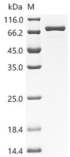 Recombinant Human Coagulation factor XI (F11) (Active) (CSB-MP007916HU(A4))