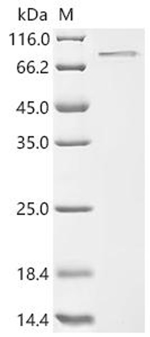 Recombinant Macaca fascicularis Activin beta-C chain, partial (CSB-MP5873MOV)