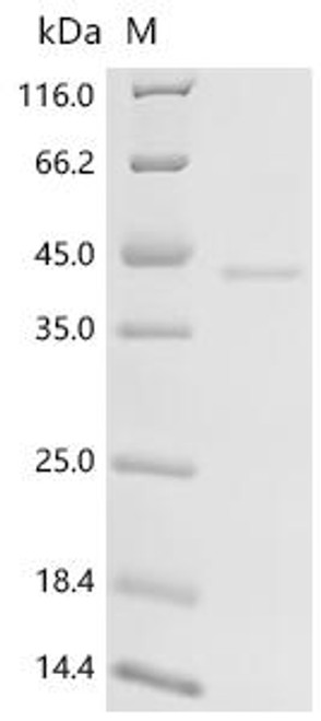 Recombinant Mouse Inhibin beta E chain (Inhbe) (CSB-MP011722MO)