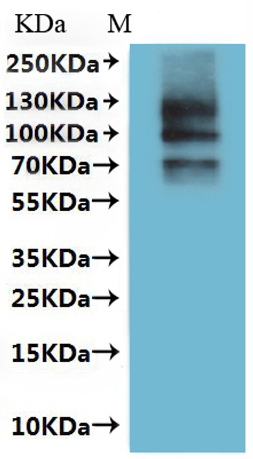 Recombinant Dog Transient receptor potential cation channel subfamily V member 6 (TRPV6)-VLPs (CSB-MP5879DO(A4))