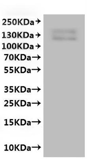 Recombinant Macaca nemestrina Transient receptor potential cation channel subfamily V member 6 (TRPV6)-VLPs (CSB-MP5880MOX(A4))