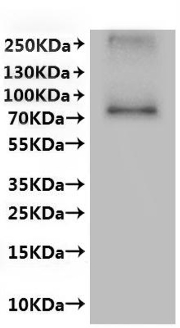 Recombinant Human Transient receptor potential cation channel subfamily V member 6 (TRPV6)-VLPs (CSB-MP861992HU)