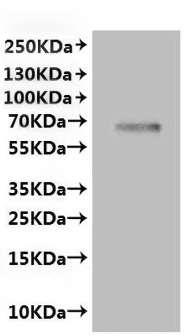 Recombinant Rat Transient receptor potential cation channel subfamily V member 6 (Trpv6)-VLPs (CSB-MP870815RA)