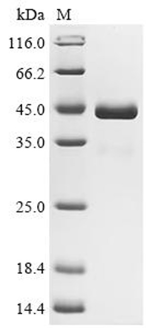 Recombinant Crimean-Congo hemorrhagic fever virus Envelopment polyprotein (GP), partial (Active) (CSB-MP810349CSC2)