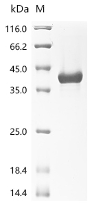 Recombinant Human High mobility group protein B1 (HMGB1), partial (CSB-MP010553HU1)