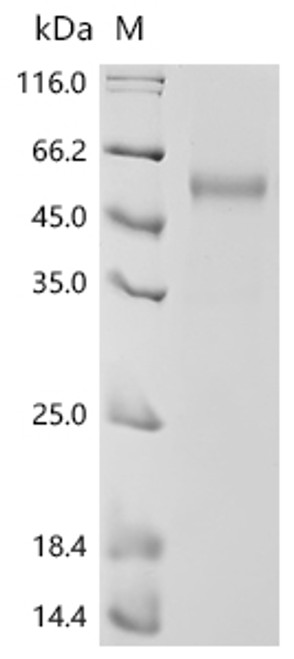Recombinant Human Natural killer cells antigen CD94 (KLRD1), partial (CSB-MP615672HU)