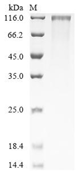 Recombinant Human Mesothelin-like protein (MSLNL), partial (CSB-MP853447HU1)