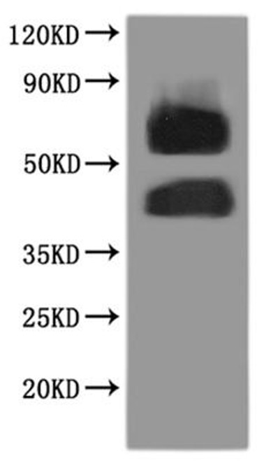 Recombinant Human N-formyl peptide receptor 2 (FPR2)-VLPs (CSB-MP008855HU)