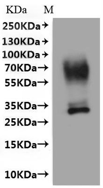 Recombinant Human Urea transporter 1 (SLC14A1)-VLPs (CSB-MP615678HU(A4)-C)