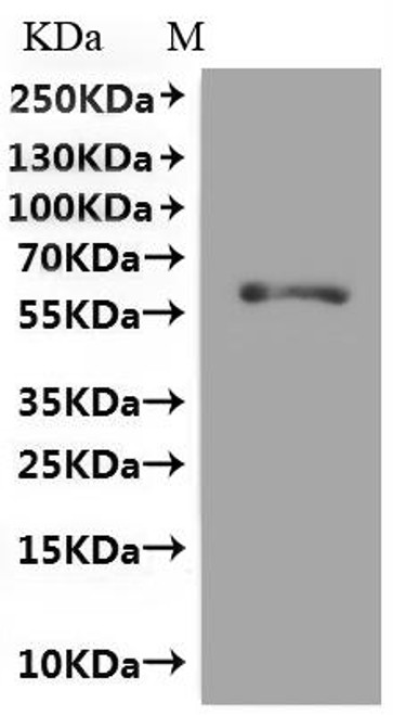 Recombinant Rat Glutamate receptor ionotropic, NMDA 1 (Grin1) (F484A,T518A,R523A,W731A), partial, Fluorescent-VLPs (CSB-MP009911RA2(M))