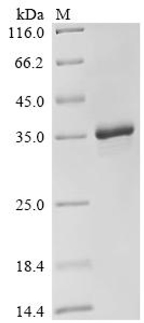 Recombinant Human Protein mono-ADP-ribosyltransferase PARP16 (PARP16), partial (CSB-MP836673HU)