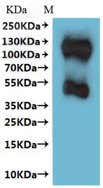 Recombinant Human Somatostatin receptor type 3 (SSTR3)-VLPs (CSB-MP022726HU)