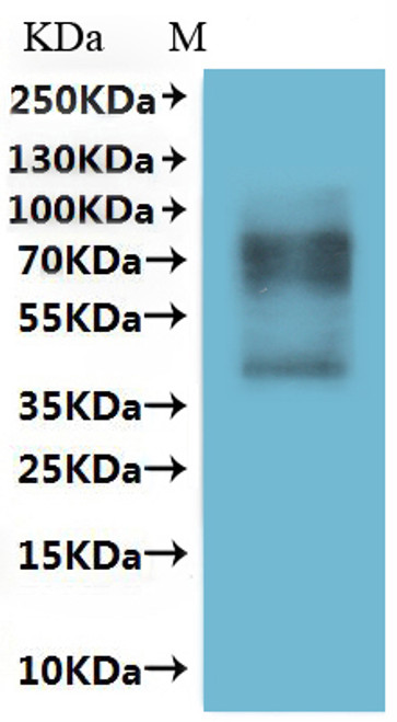 Recombinant Human Somatostatin receptor type 1 (SSTR1)-VLPs (CSB-MP022724HU)