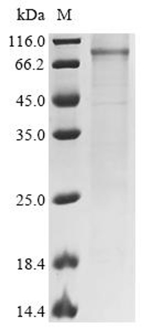 Recombinant Mouse Mannan-binding lectin serine protease 2 (Masp2) (CSB-MP856307MO)