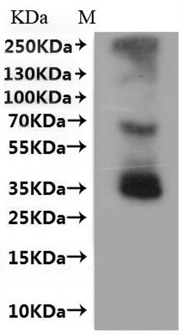 Recombinant Mouse C-C chemokine receptor type 8 (Ccr8)-VLPs (CSB-MP004847MO)