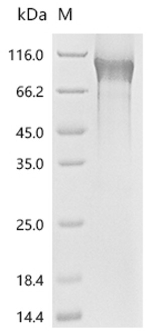 Recombinant Human Tumor necrosis factor receptor superfamily member 8(TNFRSF8), partial (CSB-MP023983HU1h6)